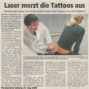 Pressebericht Tattoo Entfernung